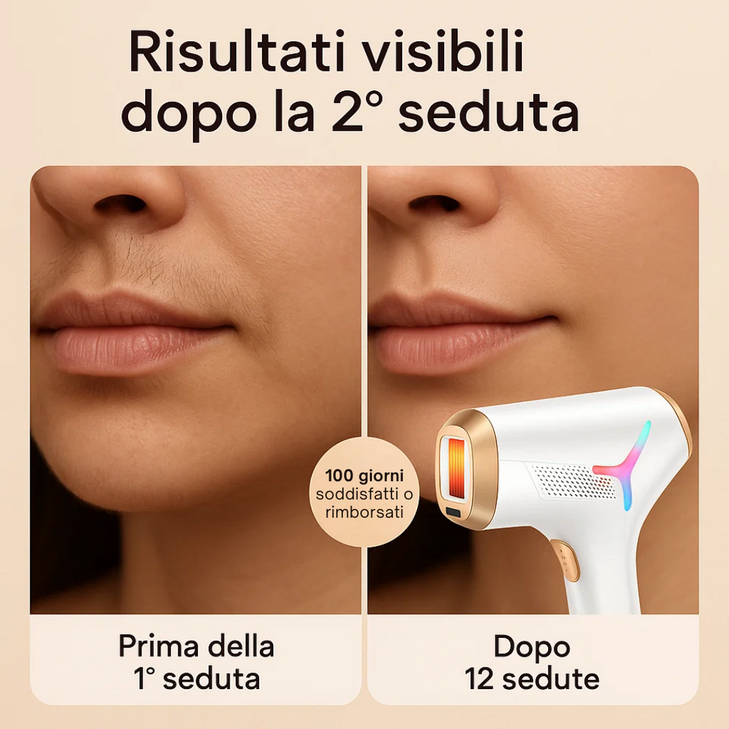 Epilatore Luce Pulsata 3in1 con Funzione Ghiaccio per Donna, Uomo, Corpo, Inguine, Viso
